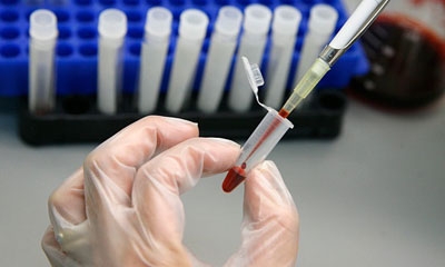 A lab technician examines blood samples for HIV.
